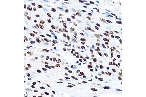 Immunohistochemistry (IHC) image for anti-Splicing Factor 3a, Subunit 3, 60kDa (SF3A3) (AA 292-501) antibody (ABIN1682671)