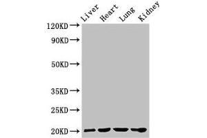 Western Blot Positive WB detected in: Rat liver tissue, Mouse heart tissue, Mouse lung tissue, Mouse kidney tissue All lanes: GPIHBP1 antibody at 4 μg/mL Secondary Goat polyclonal to rabbit IgG at 1/50000 dilution Predicted band size: 20 kDa Observed band size: 20 kDa