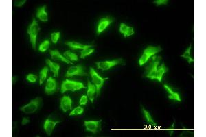 Immunofluorescence of monoclonal antibody to EEF1G on HeLa cell. (EEF1G Antikörper  (AA 1-437))
