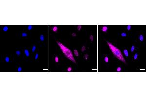 Immunocytochemical staining of H9C2 cells with Keratin 4 antibody (ABIN7799178), 1:1,000).