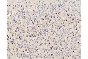 IHC analysis of PMPCA/INPP5 using anti-PMPCA/INPP5 antibody (ABIN7602722). (PMPCA Antikörper  (AA 99-525))
