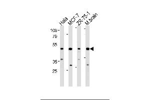 Western blot analysis in Hela,MCF-7,ZR-75-1 cell line and mouse brain lysates (35ug/lane).