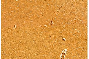 ABIN6263901 and ABIN6278065 at 1/100 staining Mouse brain tissue by IHC-P.