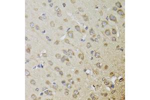 Immunohistochemistry of paraffin-embedded rat brain using CHN1 antibody (ABIN5974737) at dilution of 1/100 (40x lens). (CHN1 Antikörper)