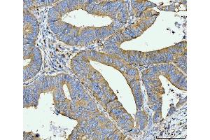 IHC analysis of FACL4/ACSL4 using anti-FACL4/ACSL4 antibody (ABIN7602779). (ACSL4 Antikörper  (C-Term))