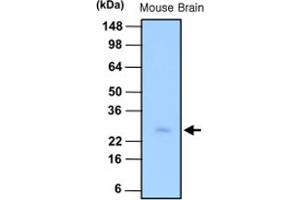 Western blot analysis of tissue lysate of mouse brain (30 ug) was resolved by SDS - PAGE , transferred to PVDF membrane and probed with PSPH monoclonal antibody , clone 3G12 (1 : 1000) . (PSPH Antikörper)