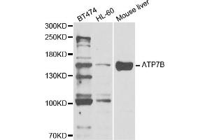 Western blot analysis of extracts of various cell lines, using ATP7B antibody. (ATP7B Antikörper)