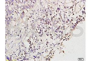 Formalin-fixed and paraffin embedded rat brain tissue labeled with Anti-MGMT Polyclonal Antibody (ABIN730768), Unconjugated at 1:200 followed by conjugation to the secondary antibody and DAB staining (MGMT Antikörper  (AA 101-207))