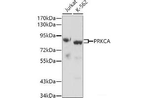 Western blot analysis of extracts of various cell lines using PRKCA Polyclonal Antibody. (PKC alpha Antikörper)