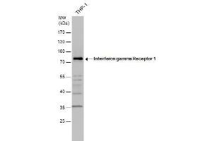 WB Image Interferon gamma Receptor 1 antibody detects Interferon gamma Receptor 1 protein by western blot analysis. (IFNGR1 Antikörper)