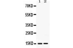 Western blot analysis of Apolipoprotein CIII expression in rat liver extract ( Lane 1) and mouse liver extract ( Lane 2). (APOC3 Antikörper  (AA 21-99))