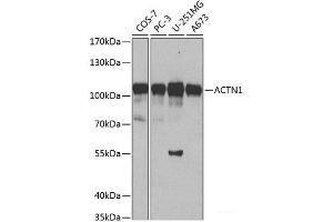 Western blot analysis of extracts of various cell lines using ACTN1 Polyclonal Antibody at dilution of 1:500. (ACTN1 Antikörper)