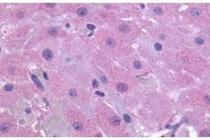 Immunohistochemical (Formalin/PFA-fixed paraffin-embedded sections) staining in human ovary with PTGFR polyclonal antibody . (PTGFR Antikörper  (2nd Extracellular Domain))