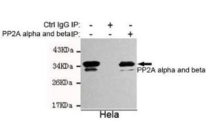 Immunoprecipitation analysis of Hela cell lysates using A alpha and beta mouse mAb. (PP2A alpha/beta Antikörper)