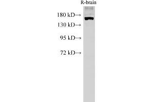 Western Blot analysis of Rat brain tissue using PARD3A Polyclonal Antibody at dilution of 1:500 (PARD3 Antikörper)