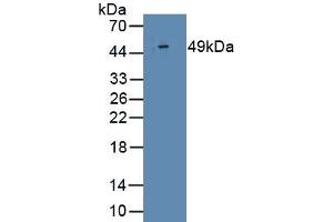 Detection of Recombinant IFNa2, Human using Monoclonal Antibody to Interferon Alpha 2 (IFNa2) (IFNA2 Antikörper  (AA 24-188))