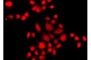 Immunofluorescence analysis of A549 cells using MLF1 Polyclonal Antibody (MLF1 Antikörper)