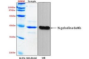 Western Blotting (WB) image for Gelsolin (GSN) (AA 1-403), (N-Term) protein (His tag) (ABIN5675807) (Gelsolin Protein (GSN) (AA 1-403, N-Term) (His tag))