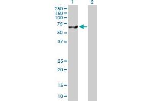 Western Blot analysis of USP14 expression in transfected 293T cell line by USP14 MaxPab polyclonal antibody. (USP14 Antikörper  (AA 1-494))