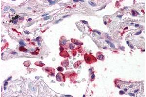 Human Lung (formalin-fixed, paraffin-embedded) stained with AIF1 antibody ABIN337364 at 5 ug/ml followed by biotinylated anti-goat IgG secondary antibody ABIN481715, alkaline phosphatase-streptavidin and chromogen. (Iba1 Antikörper  (AA 149-161))