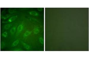 Immunofluorescence analysis of NIH-3T3 cells, using Collagen I Antibody. (Collagen Type I Antikörper  (AA 1-50))