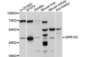 Western blot analysis of extracts of various cell lines, using GPR143 antibody (ABIN5997830) at 1/1000 dilution. (GPR143 Antikörper)