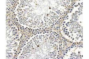 ABIN7096614 and ABIN7100678 at 1/100 staining rat testis tissue by IHC-P. (MON1A Antikörper)