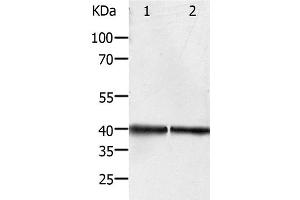Western Blot analysis of Hela and Jurkat cell using PDX1 Polyclonal Antibody at dilution of 1:450 (PDX1 Antikörper)