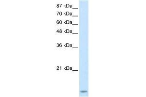 WB Suggested Anti-TARBP2 Antibody Titration:  2. (TARBP2 Antikörper  (N-Term))