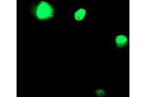 Image no. 3 for anti-T-Cell Acute Lymphocytic Leukemia 1 (TAL1) antibody (ABIN1501292) (TAL1 Antikörper)