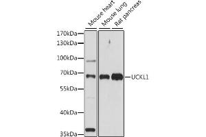 Western blot analysis of extracts of various cell lines, using UCKL1 antibody (ABIN7271233) at 1:1000 dilution. (UCKL1 Antikörper  (AA 1-200))
