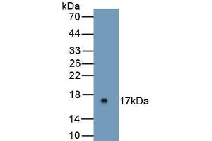 Detection of Recombinant UPK1A, Mouse using Polyclonal Antibody to Uroplakin 1A (UPK1A)