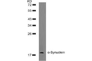 Image no. 2 for anti-Synuclein, alpha (SNCA) (AA 131-135) antibody (ABIN401570) (SNCA Antikörper  (AA 131-135))