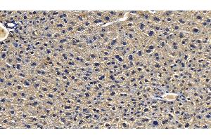 Immunohistochemistry (IHC) image for anti-Interleukin-1 Receptor-Associated Kinase 4 (IRAK4) (AA 189-427) antibody (ABIN7433738)