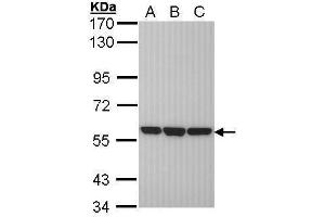 WB Image Sample (30 ug of whole cell lysate) A: H1299 B: Hela C: Hep G2 , 7. (PDIA3 Antikörper  (C-Term))