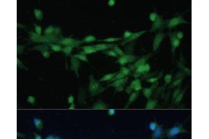 Immunofluorescence analysis of NIH-3T3 cells using CSNK2B Polyclonal Antibody at dilution of 1:100 (40x lens). (CSNK2B Antikörper)