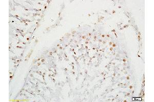 Formalin-fixed and paraffin embedded rat testis labeled with Anti-SOX9/SRA1 Polyclonal Antibody, Unconjugated (ABIN754963) at 1:200 followed by conjugation to the secondary antibody and DAB staining (SOX9 Antikörper  (AA 121-220))