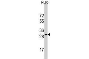 Western blot analysis of RPS6 polyclonal antibody  in HL-60 cell line lysates (35 ug/lane). (RPS6 Antikörper  (N-Term))