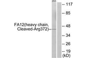 Western blot analysis of extracts from 293 cells, treated with etoposide 25uM 1h, using FA12 (heavy chain,Cleaved-Arg372) Antibody. (F12 Antikörper  (Cleaved-Arg372))