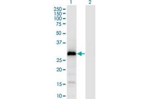 Western Blot analysis of GAGE1 expression in transfected 293T cell line by GAGE1 monoclonal antibody (M04), clone 4G6. (G Antigen 1 Antikörper  (AA 1-139))