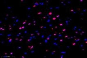 Immunofluorescent analysis of paraformaldehyde-fixed rat hippocampus using MED3 (ABIN7074581) at dilution of 1: 1000 (MED27 Antikörper)