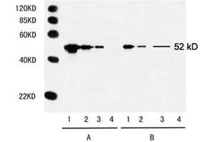 Multiple Tag Cell Lysate (ABIN1536505) Primary antibody: A. (Myc Tag Antikörper)