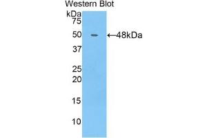 Detection of Recombinant COL14, Human using Polyclonal Antibody to Collagen Type XIV (COL14) (COL14A1 Antikörper  (AA 1280-1461))