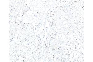Immunohistochemistry (IHC) image for anti-Achaete-Scute Complex Homolog 1 (Drosophila) (ASCL1) (AA 186-236) antibody (ABIN7455113) (Rekombinanter ASCL1 Antikörper  (AA 186-236))
