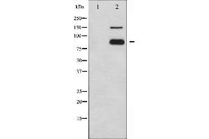 Western blot analysis of PECAM-1 phosphorylation expression in Jurkat whole cell lysates,The lane on the left is treated with the antigen-specific peptide. (CD31 Antikörper  (pTyr713))