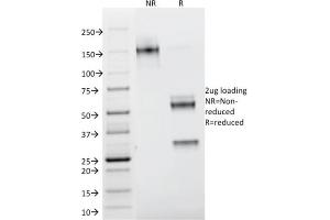 SDS-PAGE (SDS) image for anti-Lectin, Galactoside-Binding, Soluble, 1 (LGALS1) (AA 12-108) antibody (ABIN6939958)