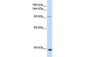 WB Suggested Anti-IFIH1 Antibody Titration:  0. (IFIH1 Antikörper  (Middle Region))
