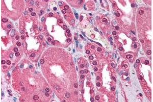 Human Kidney (formalin-fixed, paraffin-embedded) stained with ATM antibody ABIN213900 at 1-2 ug/ml followed by biotinylated goat anti-rabbit IgG secondary antibody ABIN481713, alkaline phosphatase-streptavidin and chromogen. (ATM Antikörper  (C-Term))