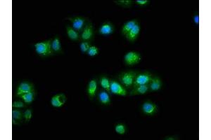 Immunofluorescence staining of HepG2 cells with ABIN7172220 at 1:100, counter-stained with DAPI. (Titin Antikörper  (AA 5398-5604))