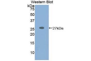 Western Blotting (WB) image for anti-Protease, Serine 2 (PRSS2) (AA 29-240) antibody (ABIN1860327) (PRSS2 Antikörper  (AA 29-240))